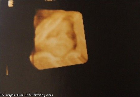 سونوگرافی 5 . هفته 21  سونو سلامت جنین . قربونت بره مامان با این عکست
