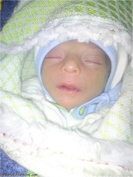 برسامی در بدو تولد