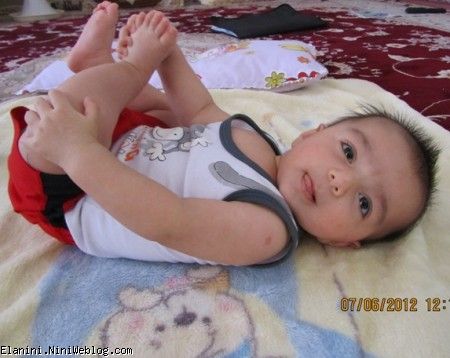 رادینم