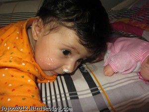 غذای کمکی نوزاد