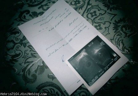 اولین سونو گرافی