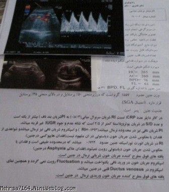دومین سونو گرافی در سال 1393