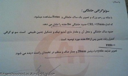اولین سونوگرافی