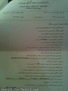 غربالگری