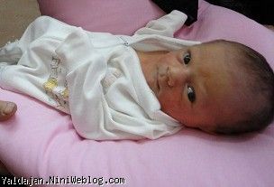 عصرروزچهارم یلدا زردی داشت گذاشتیمش توی دستگاه